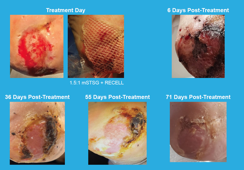 casestudy-photos